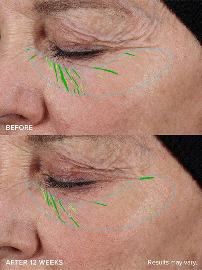 Needle-less® Growth Factor Serum